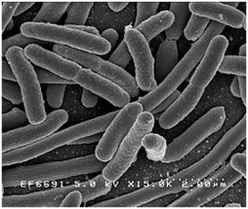 Bakterier under mikroskop – Wikipedia