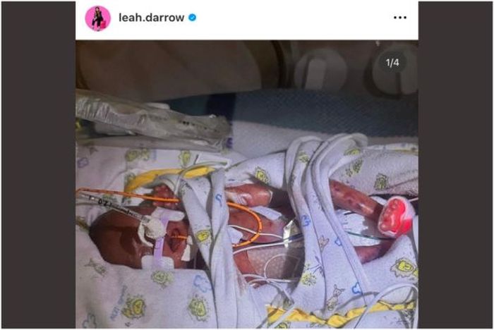 Leah Darrows nyfödda bebis behöver våra böner